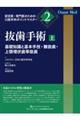 抜歯手術 上