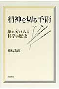 精神を切る手術 / 脳に分け入る科学の歴史