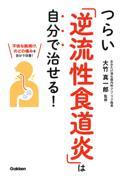 つらい「逆流性食道炎」は自分で治せる!