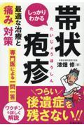 しっかりわかる帯状疱疹　最適な治療と痛み対策