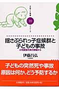 揺さぶられっ子症候群と子どもの事故