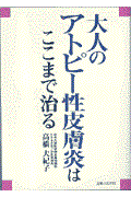 大人のアトピー性皮膚炎はここまで治る