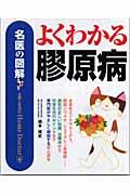 よくわかる膠原病 / 名医の図解