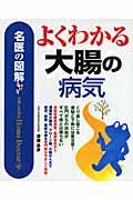 よくわかる大腸の病気