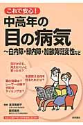 これで安心！中高年の目の病気