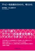 アトピー性皮膚炎のみかた，考えかた