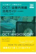 「どう使う？」が解決する！ＯＣＴ／血管内視鏡活用ガイド