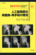 人工股関節の再置換・再手術の現況