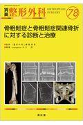 骨粗鬆症と骨粗鬆症関連骨折に対する診断と治療