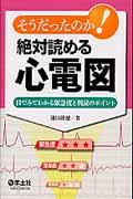 そうだったのか！絶対読める心電図