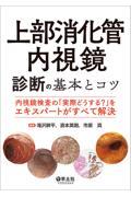 上部消化管内視鏡　診断の基本とコツ