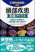 圧倒的画像数で診る！頭部疾患画像アトラス