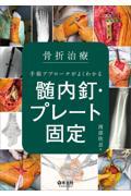 骨折治療　手術アプローチがよくわかる髄内釘・プレート固定