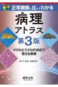 正常画像と比べてわかる病理アトラス