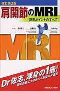 肩関節のＭＲＩ