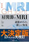 肩関節のＭＲＩ