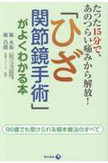 「ひざ関節鏡手術」がよくわかる本