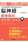 脳神経画像解剖ナビゲーション