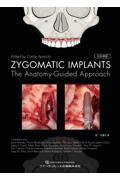 ＺＹＧＯＭＡＴＩＣ　ＩＭＰＬＡＮＴＳ　日本語版