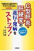 Ｃ型肝炎・肝硬変の進行・発病をストップ！