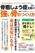 骨粗しょう症を防ぐ強い骨のつくり方