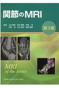 関節のＭＲＩ