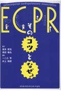 ＥＣＰＲ：そのコツとなぜ？