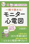 一瞬で読める！モニター心電図