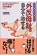 足の親指の曲がり「外反母趾」は自分で治せる / 足の痛みと変形を解消する整形外科医考案のDSIS療法