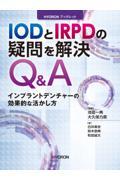 ＩＯＤとＩＲＰＤの疑問を解決Ｑ＆Ａ