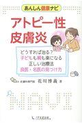 アトピー性皮膚炎 / どうすれば治る?子どもも親も楽になる正しい治療法良医・名医の見つけ方