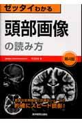 ゼッタイわかる頭部画像の読み方