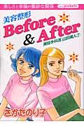 美容整形ｂｅｆｏｒｅ　＆　ａｆｔｅｒ