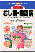 徹底図解むし歯・歯周病 / 「一生笑顔」を約束する新しい歯科の知識