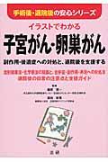 イラストでわかる子宮がん・卵巣がん / 副作用・後遺症への対処と、退院後を支援する