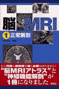 脳ＭＲＩ