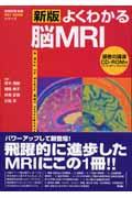 よくわかる脳ＭＲＩ