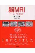 脳MRI 1 第2版