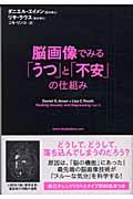 脳画像でみる「うつ」と「不安」の仕組み