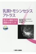 乳房トモシンセシスアトラス　乳がん検診での読影のポイント
