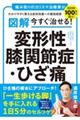 図解　今すぐ治せる！　変形性膝関節症・ひざ痛