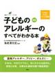 子どものアレルギーのすべてがわかる本　新版