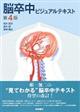 脳卒中ビジュアルテキスト　第４版