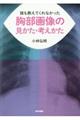 誰も教えてくれなかった胸部画像の見かた・考えかた