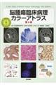 脳腫瘍臨床病理カラーアトラス　第４版
