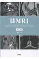 膝MRI 第4版