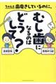 ちゃんと歯磨きしているのに、むし歯になるのはどうして？