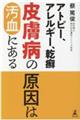 アトピー、アレルギー、乾癬皮膚病の原因は汚血にある