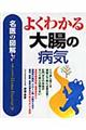 よくわかる大腸の病気