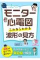 モニター心電図これならわかる波形の見方